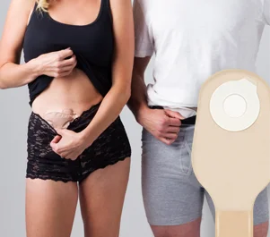 una mujer y un hombre mostrando sus estomas